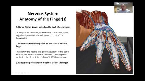 How to Perform a Digital Nerve Block - Live Demonstration - YouTube