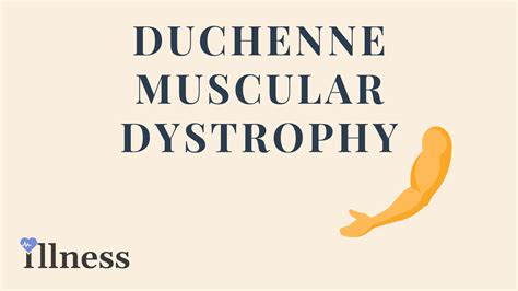 Duchenne Muscular Dystrophy : Overview, Causes, Symptoms, Treatment - illness.com