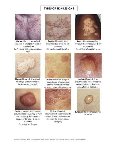 skin lesions