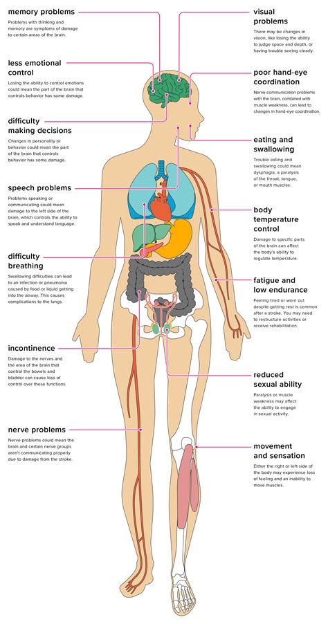 The Effects of Stroke on the Body