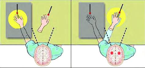 The rubber-hand illusion. A healthy subject experiences an artificial... | Download Scientific ...