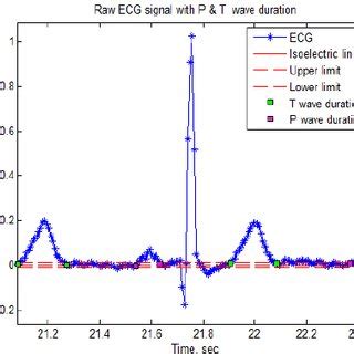 ECG signal with isoelectric line and P and T wave durations | Download ...