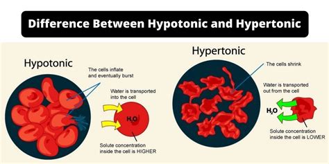 Difference Between Hypertonic vs Hypotonic