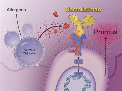 Nemolizumab for Atopic Dermatitis | New England Journal of Medicine