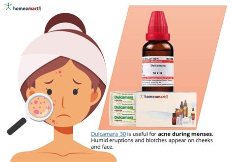 Best homeopathy medicines for acne by indications in pills, drops – Homeomart