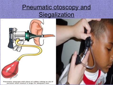 Auditory tube function - holdenbg