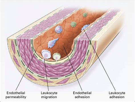 Endothelial Dysfunction in Atherosclerosis. The earliest changes that ...