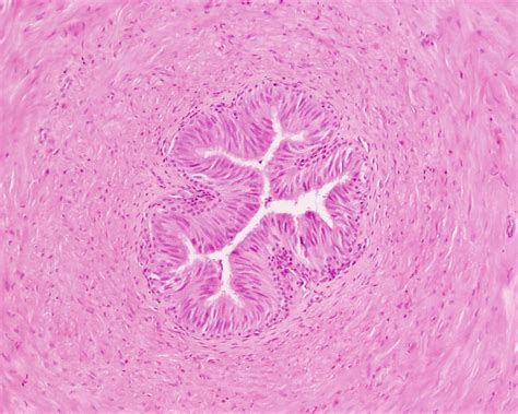 File:Testis histology 016.jpg - Embryology