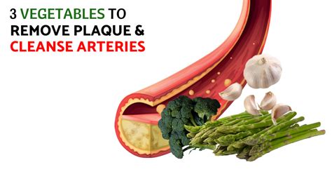 3 Vegetables To Regulate Plaque Build Up & Support Clean Arteries | 2024