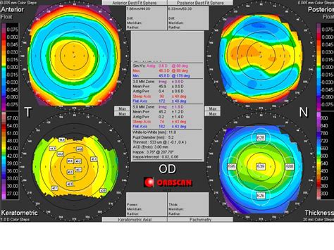 Corneal Topography - EyeWiki