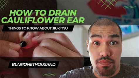 How To Drain Cauliflower Ear - YouTube