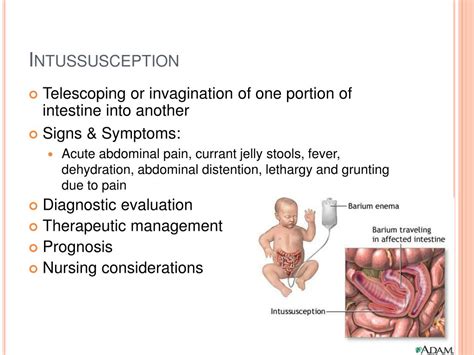 PPT - The Child with Gastrointestinal Dysfunction PowerPoint ...