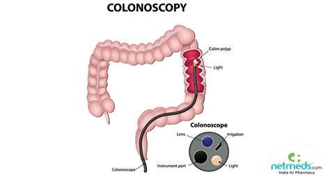 Colonoscopy: Procedure, Risks And Results