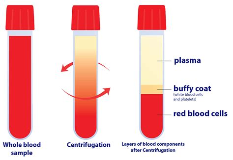 Blood plasma anatomy. White, red blood cell human platelet. Before