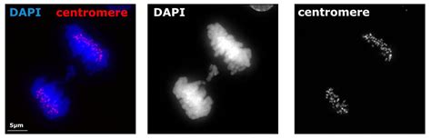 Anti-Centromere Protein Antibody