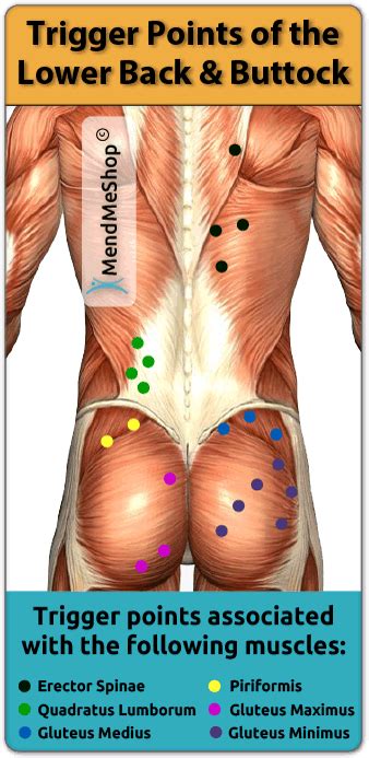 Trigger Points Hip & Back