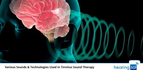 Tinnitus Sound Therapy | Various Sounds & Best Technologies