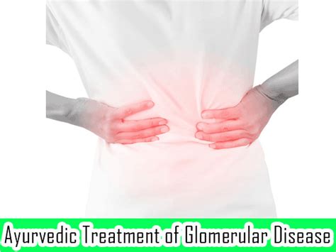 Ayurvedic Treatment of Glomerular Disease - Planet Ayurveda