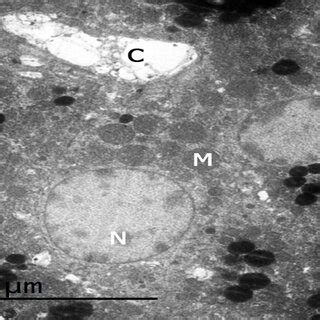 An electron photomicrograph of the zona fasiculata of the control group... | Download Scientific ...