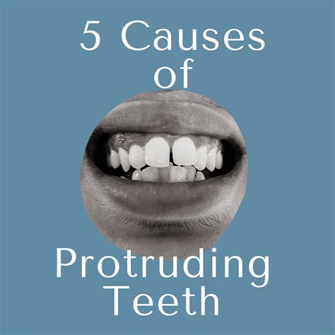 5 Causes of Protruding Teeth | Kids Dental Specialists