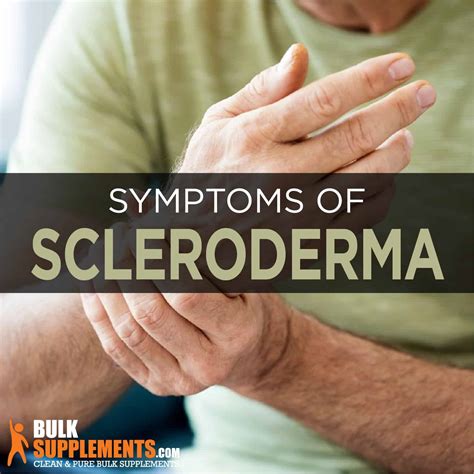 Scleroderma: Symptoms, Causes & Treatment