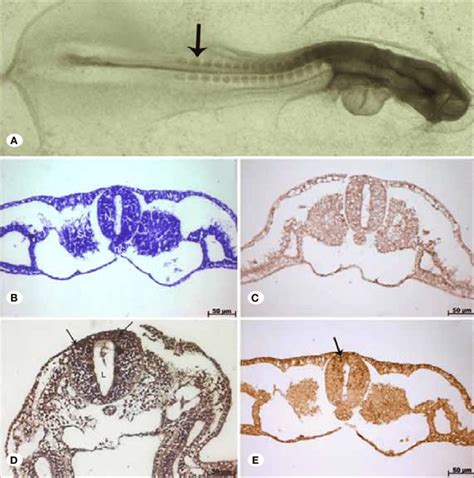 A) Stereomicroscopic image of closed NT of chick embryo at group I; B)... | Download Scientific ...