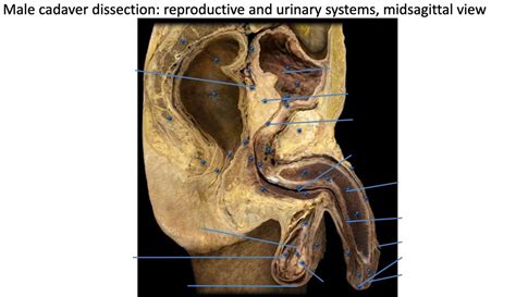 Morgue Chaqueta cartucho cadaver anatomy diagonal Pegajoso ideología