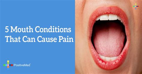 5 Mouth Conditions That Can Cause Pain