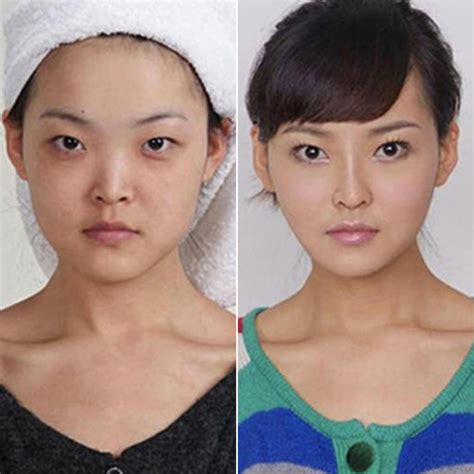 Extreme Plastic Surgery Causes Passport Confusion | POPSUGAR Beauty Photo 8