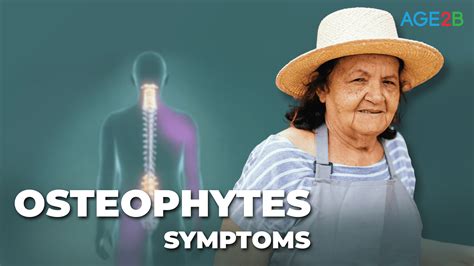 Osteophytes | Symptoms - AGE2B