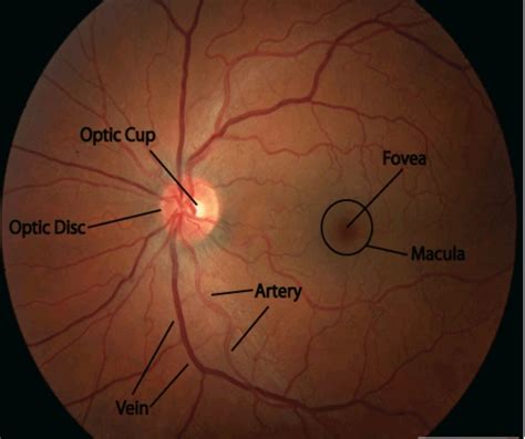 Procedure of Fundus Examination - Optography