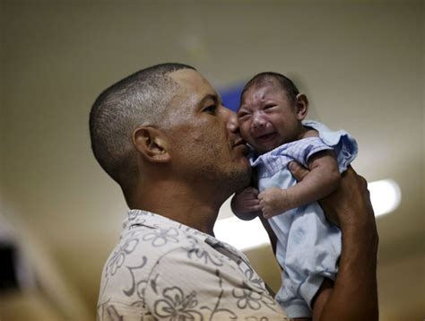 Microcephaly: What is the disease caused by Zika which damages babies ...