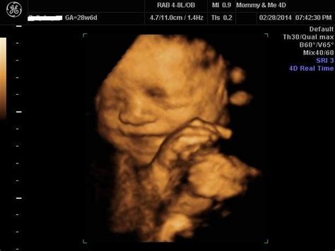 3d early gender ultrasound near me - Hellen Kidwell