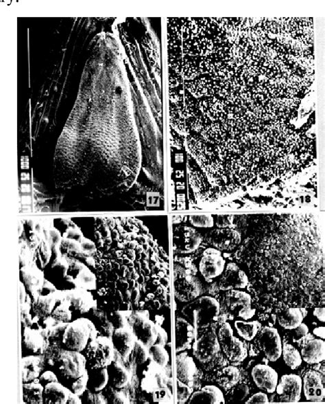 Figure 18 from The fine structure of the dorsal lingual epithelium of the scincine lizard ...