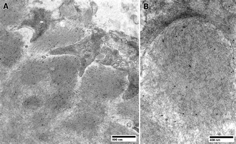 Magnification: ×15,000. Transmission electron microscopy. Uranyl... | Download Scientific Diagram