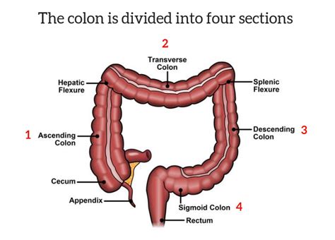 About Colorectal Cancer: Symptoms, Risk Factors, Diagnosis & Stages ...