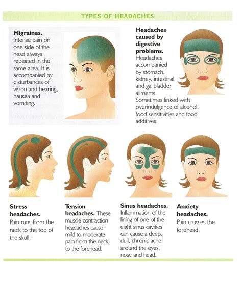 Useful guide for massage therapists and self care for headache massage ...