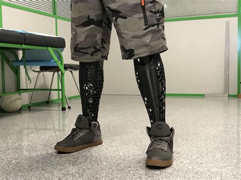 3D Printed Prosthetic Covers [Honey Comb Pattern] : r/Prosthetics