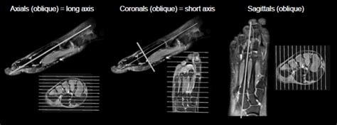 Ankle/Foot MRI