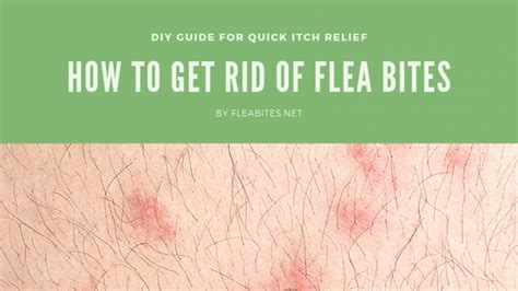 Flea Bite Treatment - How to Get Rid of Flea Bites - FLEABITES