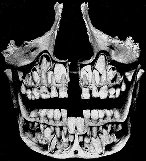 Teeth - Lozier Institute