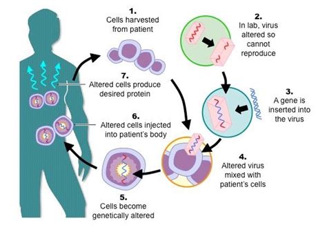 Gene therapy – Science of Healthy