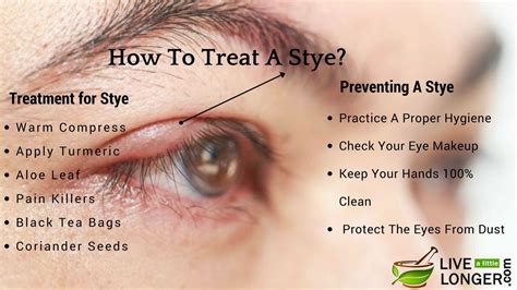 How To Treat A Stye? – 8 Ways To Make You Relax | Treating a stye, Eye stye remedies, Stye treatment