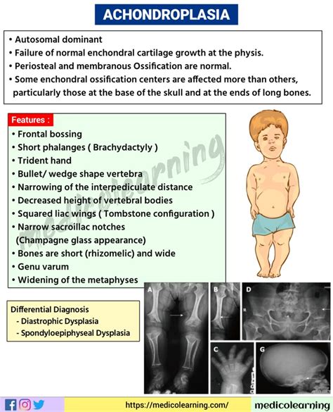 Achondroplasia Symptoms