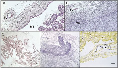 Fetal membranes and umbilical cord histology. (A) Normal chorionic... | Download Scientific Diagram