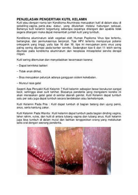 (DOC) PENJELASAN KUTIL KELAMIN.docx | Klinik Raphael - Academia.edu