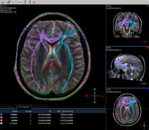 Image | Radiopaedia.org