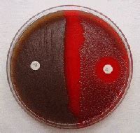 Optochin Sensitivity Test: Principle, Procedure, expected results and quality control