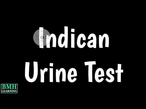 Indican Urine test | Urinary Indican Testing | - YouTube