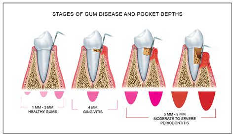 New Patients - What to Expect